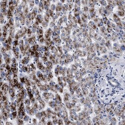 ACOX1 Antibody, Novus Biologicals 0.1mL; Unlabeled:Antibodies, Polyclonal